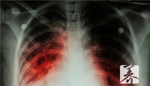 老人肺部感染致死征兆