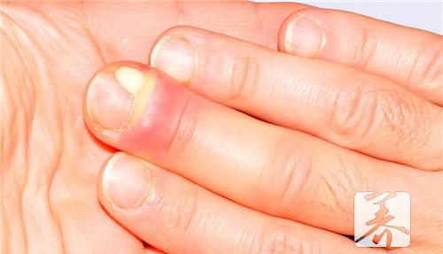 老人大腿肿痛到底是怎么回事呢？