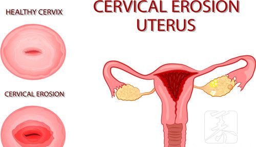 hpv39阳性多久能自愈