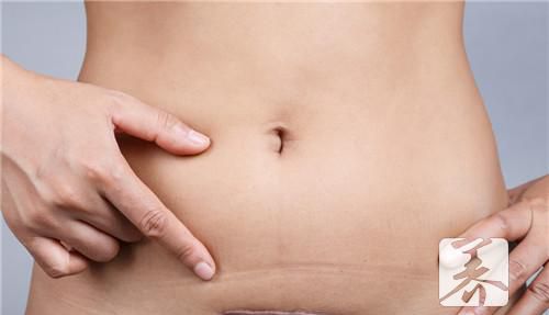 剖腹产后8个月怀孕案例