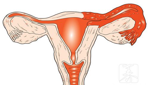 女性卵巢早衰是什么原因引起的