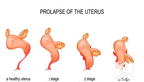 子宫内膜薄能正常怀孕吗