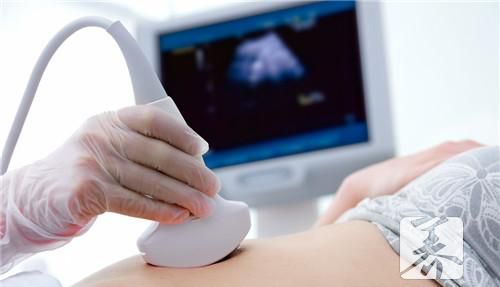 女性腹部b超检查什么