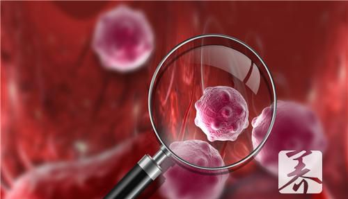 ​卵巢浆液性囊腺瘤临床表现