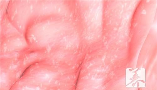 子宫内膜息肉样增生如何治疗