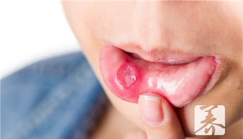 手足口病的食疗方 5款食疗方治疗手足口病