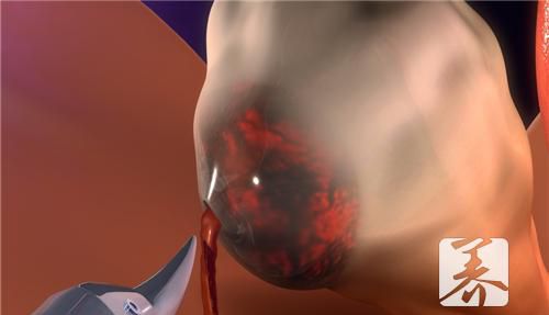 积乳囊肿的偏方