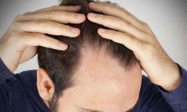 秋季脱发严重怎么办_秋天如何防止脱发