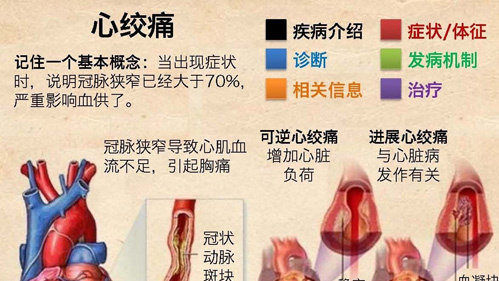 高血压导致心绞痛的原因、表现症状与处理措施