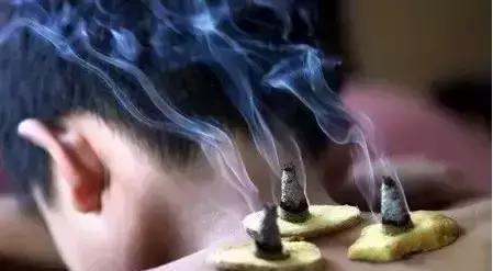 冻疮艾灸有用吗？艾灸怎么调理？灸那几个部位？