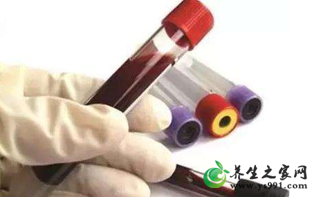 血瘀体质形成的原因_导致血瘀体质的6大因素