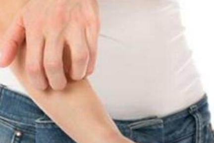 麻黄附子细辛汤加味治疗过敏性皮炎医案案例