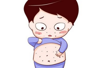 麻黄细辛附子汤合麻黄连翘赤小豆汤治疗荨麻疹瘾疹医案
