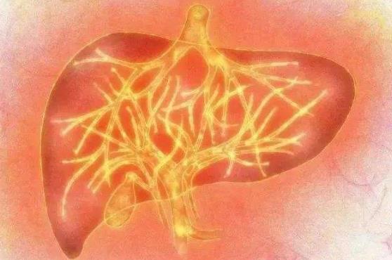 脾气大、血压高是肝火旺盛引起的吗？肝火旺盛怎么调理