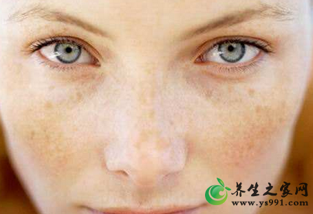 什么是瘀血体质？血瘀体质的特点特征及表现
