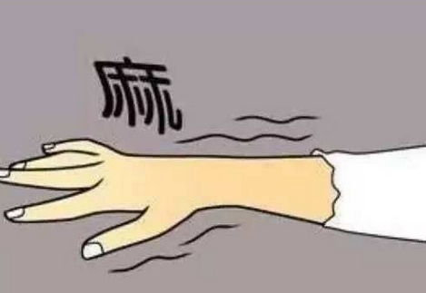 黄芪桂枝五物汤合当归四逆治疗卵巢癌化疗后手足麻木(血痹)案